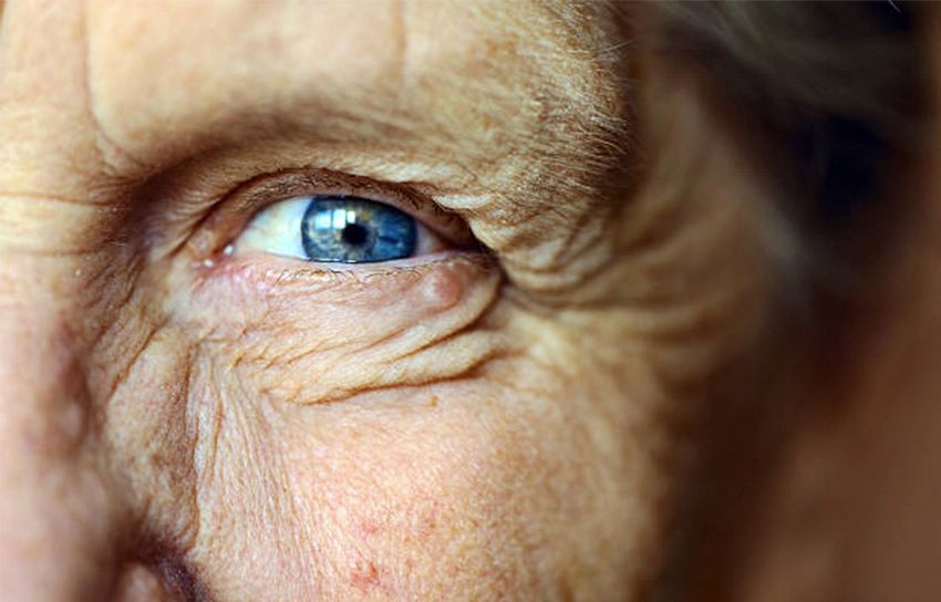 How Aging Effects Your Eyes | 39dollarglasses.com Blog